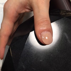 自爪育成（自爪状態：中度）2回目のご来店時